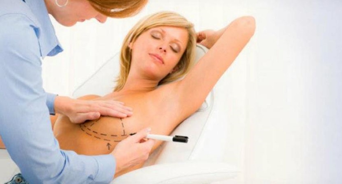 chirurgia estetica al seno