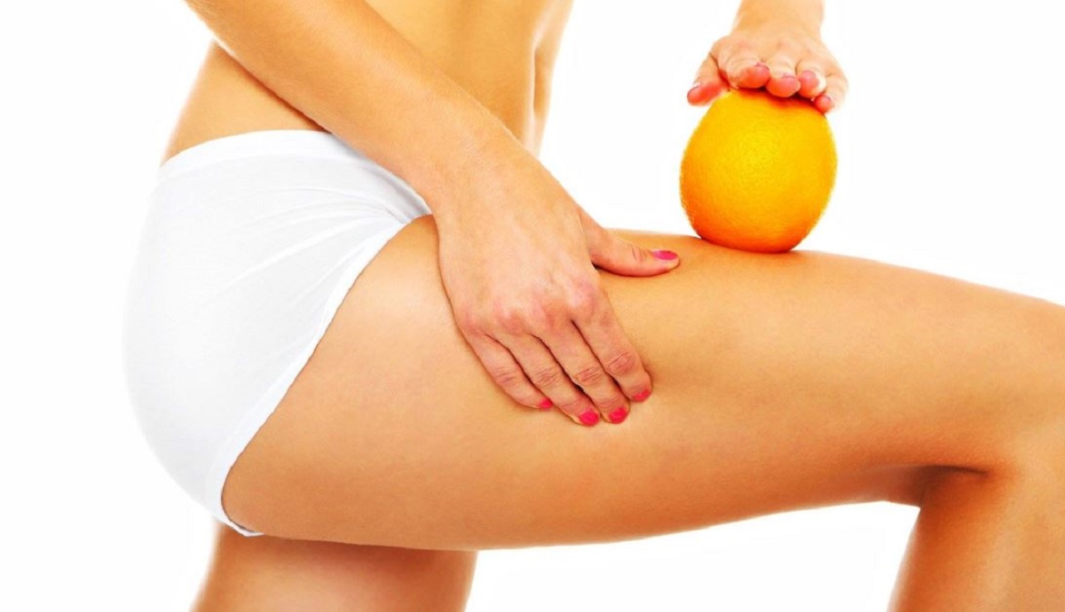 ionoforesi cellulite